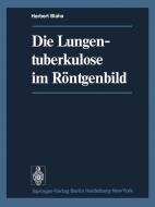 Die Lungentuberkulose im Röntgenbild di H. Blaha edito da Springer Berlin Heidelberg