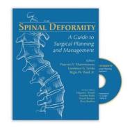 Spinal Deformity: A Guide to Surgical Planning and Management edito da QUALITY MEDICAL PUB