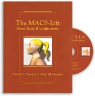 The Macs-lift Short Scar Rhytidectomy di Patrick L Tonnard edito da Thieme Medical Publishers Inc