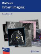 Breast Imaging di Lonie Salkowski edito da Thieme Georg Verlag