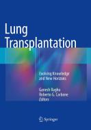 Lung Transplantation edito da Springer International Publishing
