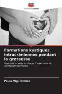 Formations kystiques intracrâniennes pendant la grossesse di Paula Vigil Doblas edito da Editions Notre Savoir