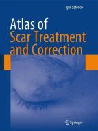 Atlas of Scar Treatment and Correction di Igor Safonov edito da Springer Berlin Heidelberg