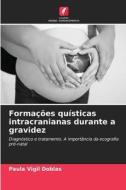 Formações quísticas intracranianas durante a gravidez di Paula Vigil Doblas edito da Edições Nosso Conhecimento