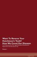 Want To Reverse Your Hutchinson's Teeth? How We Cured Our Diseases. The 30 Day Journal for Raw Vegan Plant-Based Detoxif di Health Central edito da Raw Power