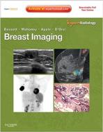 Breast Imaging edito da Elsevier Health Sciences