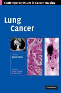 Lung Cancer di Sujal R. Desai edito da Cambridge University Press