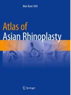 Atlas of Asian Rhinoplasty di Man Koon Suh edito da Springer Singapore