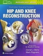 Illustrated Tips and Tricks in Hip and Knee Reconstructive and Replacement Surgery edito da Lippincott Williams&Wilki