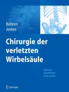 Chirurgie der verletzten Wirbelsäule edito da Springer-Verlag GmbH