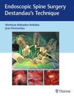 Endoscopic Spine Surgery edito da Thieme Medical Publishers