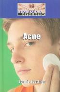 Acne di Bonnie Juettner edito da Lucent Books