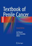 Textbook of Penile Cancer edito da Springer-Verlag GmbH
