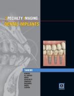 Specialty Imaging: Dental Implants di Dania Tamimi edito da AMIRSYS