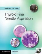Thyroid Fine Needle Aspiration di Grace C. H. Yang edito da Cambridge University Press