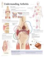 Understanding Arthritis Laminated Poster di Scientific Publishing edito da Scientific Publishing