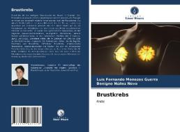 Brustkrebs di Guerra Luis Fernando Menezes Guerra, Novo Benigno Nunez Novo edito da KS OmniScriptum Publishing