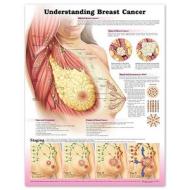 Understanding Breast Cancer edito da Lippincott Williams And Wilkins