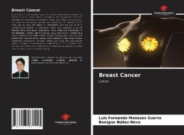 Breast Cancer di Guerra Luis Fernando Menezes Guerra, Novo Benigno Nunez Novo edito da KS OmniScriptum Publishing