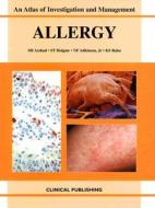 Allergy di S. H. Arshad edito da CRC Press
