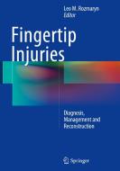 Fingertip Injuries edito da Springer-Verlag GmbH