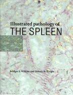 Illustrated Pathology of the Spleen di Bridget S. Wilkins edito da Cambridge University Press