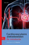 Cardiovasculaire Ziektebeelden edito da Bohn Stafleu Van Loghum