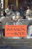 Invasion of the Body - Revolutions in Surgery di Nicholas L. Tilney edito da Harvard University Press