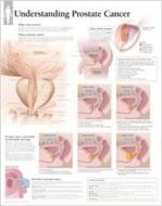Understanding Prostate Cancer Paper Poster di Scientific Publishing edito da Scientific Publishing Limited