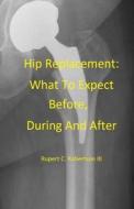 Hip Replacement: What to Expect Before, During and After di Rupert C. Robertson edito da Createspace