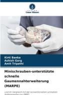 Minischrauben-unterstützte schnelle Gaumennahterweiterung (MARPE) di Kirti Banka, Ashish Garg, Amit Tripathi edito da Verlag Unser Wissen