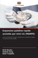 Expansion palatine rapide assistée par mini-vis (MARPE) di Kirti Banka, Ashish Garg, Amit Tripathi edito da Editions Notre Savoir