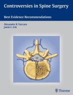 Controversies in Spine Surgery di Alexander R. Vaccaro, Jason C. Eck edito da Thieme Georg Verlag