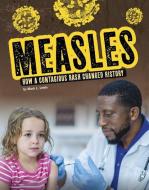 Measles: How a Contagious Rash Changed History di Mark K. Lewis edito da CAPSTONE PR