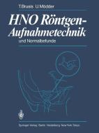 HNO Röntgen-Aufnahmetechnik und Normalbefunde di T. Brusis, U. Mödder edito da Springer Berlin Heidelberg
