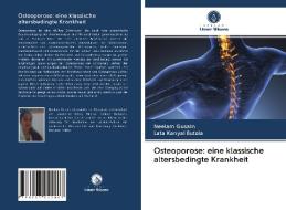 Osteoporose: eine klassische altersbedingte Krankheit di Neelam Gusain, Lata Kanyal Butola edito da Verlag Unser Wissen