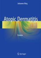 Atopic Dermatitis di Johannes Ring edito da Springer-Verlag GmbH
