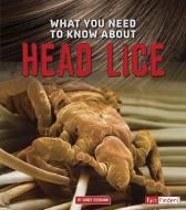 What You Need to Know about Head Lice di Nancy Dickmann edito da CAPSTONE PR
