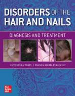 Disorders of the Hair and Nail: Diagnosis and Treatment di Antonella Tosti, Bianca Maria Piraccini edito da MCGRAW HILL EDUCATION & MEDIC