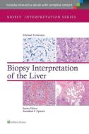 Biopsy Interpretation of the Liver di Michael Torbenson edito da Lippincott Williams&Wilki
