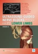 Ultrasound-Guided Nerve Blocks on DVD Vs 2.0: Lower Limbs for PC di Alain Delbos edito da LIPPINCOTT RAVEN