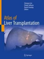 Atlas of Liver Transplantation di Chetana Lim, Daniel Azoulay, Chady Salloum edito da Springer International Publishing