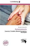 Acrocyanosis edito da Cede Publishing