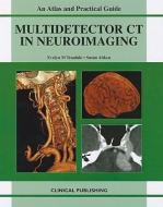 Multidetector Ct In Neuroimaging di Evelyn Teasdale, Susan Aitken edito da Clinical Publishing,an Imprint Of Atlas Medical Publishing L