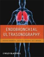 Endobronchial Ultrasonography di Noriaki Kurimoto, David Fielding, Ali I. Musani edito da Wiley John + Sons
