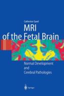 Mri Of The Fetal Brain di C. Garel edito da Springer-verlag Berlin And Heidelberg Gmbh & Co. Kg
