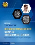 Integrated Management Of Complex Intracranial Lesions Hardback Set And Static Online Product edito da Cambridge University Press