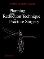 Planning and Reduction Technique in Fracture Surgery di Reinhold Ganz, Roland Jakob, Jeffrey Mast edito da Springer Berlin Heidelberg