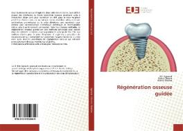 Régénération osseuse guidée di Eiti Agrawal, Rahul Chopra, Nikhil Sharma edito da Editions universitaires europeennes EUE