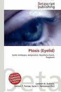 Ptosis (Eyelid) edito da Betascript Publishing